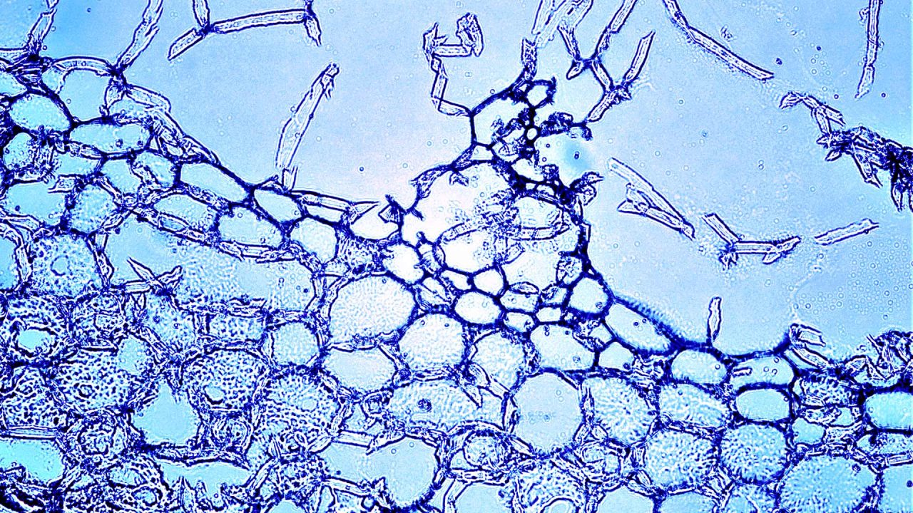 Mechanism Of Action In Aloe Vera Ibs